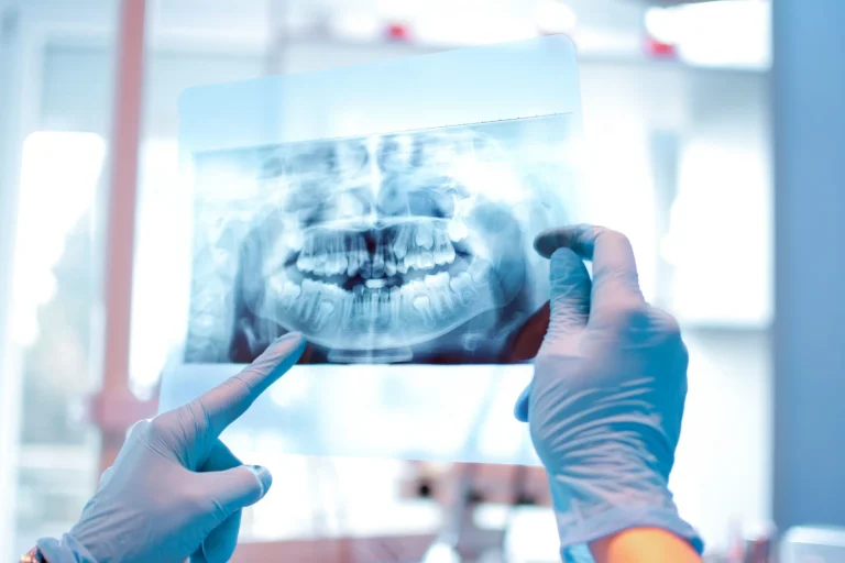 Πανοραμική Ακτινογραφία Δοντιών - Οδοντίατροι Λάρισα - Κολώνα Χάιδω Βασιλική