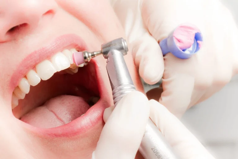 Κάνετε Τακτικό Καθαρισμό Δοντιών - Οδοντίατροι Λάρισα - Κολώνα Χάιδω Βασιλική