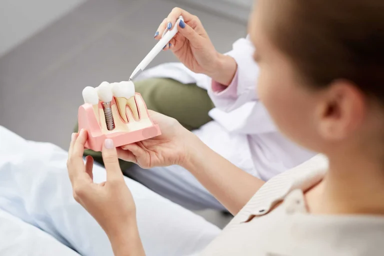 Οδοντικά Εμφυτεύματα: Συμβουλές μετά την Τοποθέτηση - Οδοντίατροι Λάρισα - Κολώνα Χάιδω Βασιλική