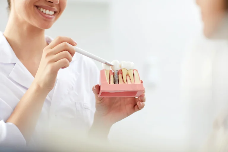 Τα Καλύτερα Εμφυτεύματα Δοντιών ~ Οδοντίατροι Λάρισα ~ Κολώνα Χάιδω-Βασιλική