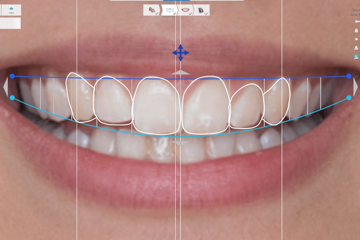 Smile Design Λάρισα ~ Οδοντίατροι Λάρισα ~ Κολώνα Χάιδω-Βασιλική