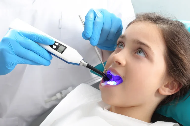 Sealants Δοντιών: Αποτελεσματικά κατά της Τερηδόνας ~ Οδοντίατροι Λάρισα - Κολώνα Χάιδω Βασιλική