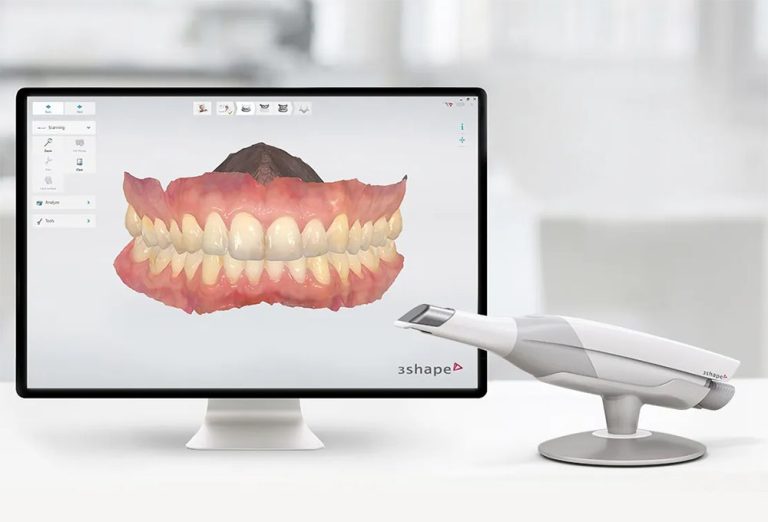 3D Oral Scanner 3Shape ~ Οδοντιατρος Λαρισα ~ Κολώνα Χάιδω-Βασιλική